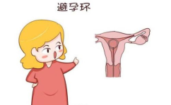 刚上环能做和私密吗,私密生活如何和谐进行？